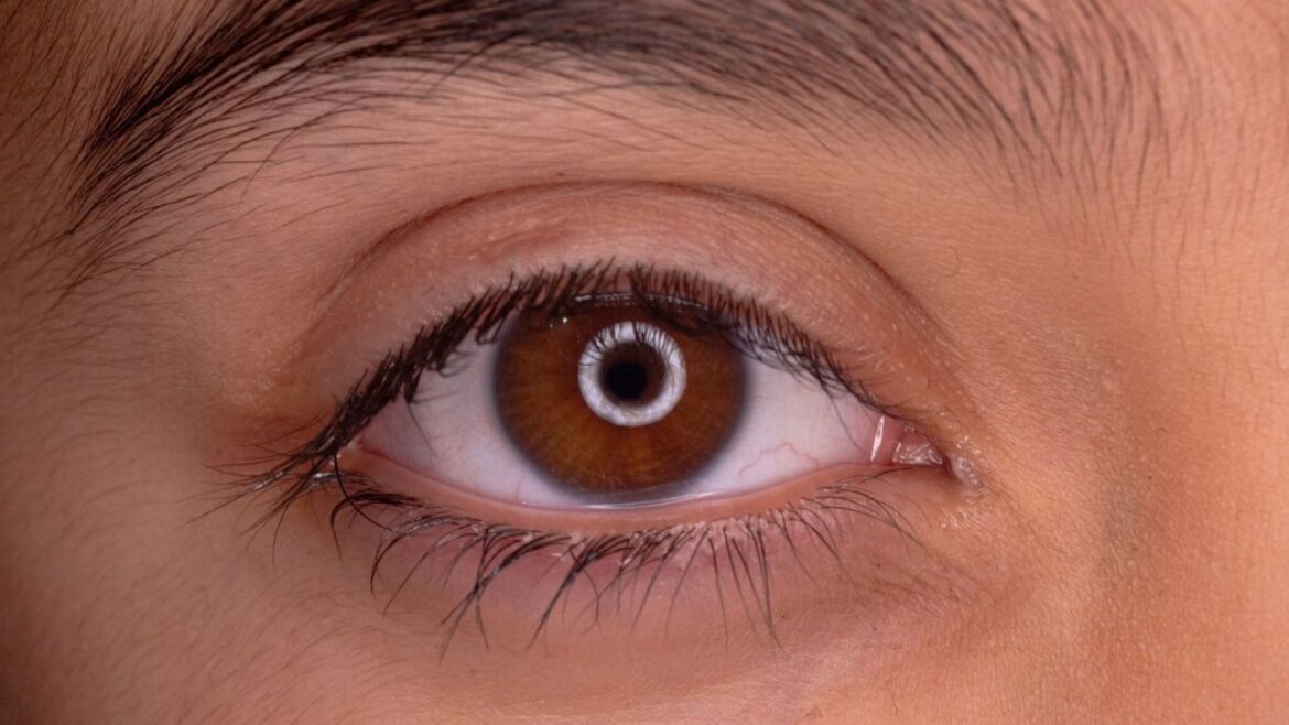El origen de tus ojos: un antiguo gusano cíclope de hace 600 millones de años - evolución de los ojos